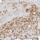 Anti-RNF146 Antibody