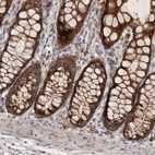 Anti-MRPL41 Antibody