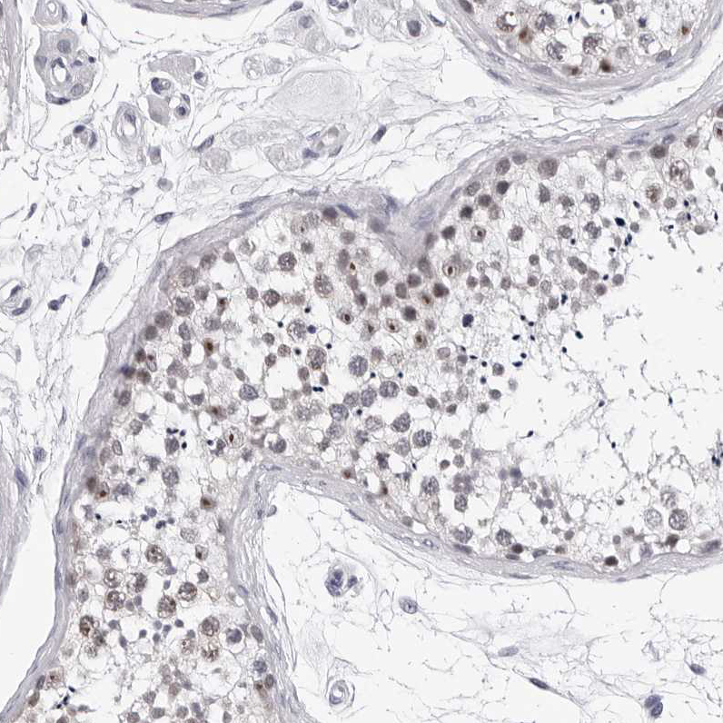 Anti-GNL2 Antibody