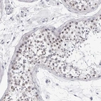 Anti-GNL2 Antibody