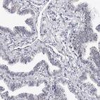 Immunohistochemical staining of human fallopian tube shows moderate positivity in nucleoli in glandular cells.
