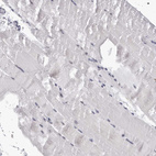 Immunohistochemical staining of human skeletal muscle shows moderate positivity in nucleoli in myocytes.