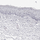 Immunohistochemical staining of human skin shows moderate positivity in nucleoli in squamous epithelial cells.