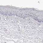 Immunohistochemical staining of human skin shows moderate positivity in nucleoli in squamous epithelial cells.