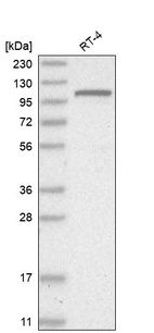 Western blot analysis in human cell line RT-4.