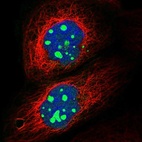 Immunofluorescent staining of human cell line A-431 shows localization to nucleoli.