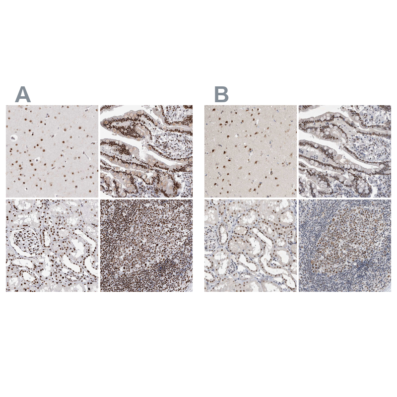 Anti-RBM6 Antibody