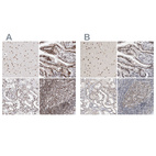 Anti-RBM6 Antibody