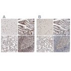 Anti-RBM6 Antibody