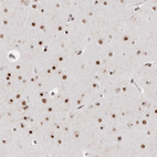 Immunohistochemical staining of human cerebral cortex shows strong nuclear positivity in neurons.