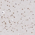 Immunohistochemical staining of human cerebral cortex shows strong nuclear positivity in neurons.