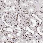 Immunohistochemical staining of human kidney shows strong nuclear positivity in cells in tubules.