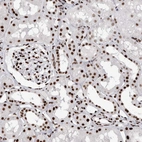 Immunohistochemical staining of human kidney shows strong nuclear positivity in cells in tubules.