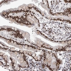 Immunohistochemical staining of human colon shows strong nuclear positivity in glandular cells.