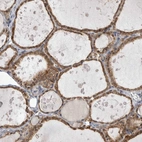 Immunohistochemical staining of human thyroid gland shows strong granular cytoplasm positivity in glandular cells.