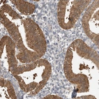 Immunohistochemical staining of human endometrium shows strong granular cytoplasm positivity in glandular cells.