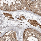 Immunohistochemical staining of human testis shows strong granular cytoplasm positivity in Leydig cells and cells in seminiferous ducts.