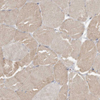 Immunohistochemical staining of human skeletal muscle shows weak granular cytoplasm positivity in myocytes.