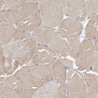 Immunohistochemical staining of human skeletal muscle shows weak granular cytoplasm positivity in myocytes.