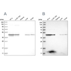 Anti-KYAT3 Antibody