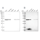 Western blot analysis using Anti-KYAT3 antibody HPA027168 (A) shows similar pattern to independent antibody HPA026538 (B).