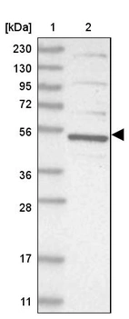 Lane 1: Marker [kDa] 230, 130, 95, 72, 56, 36, 28, 17, 11_br/_Lane 2: Human cell line RT-4