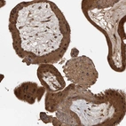 Anti-AKAP7 Antibody