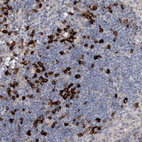 Anti-MASTL Antibody