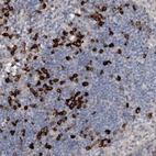 Anti-MASTL Antibody