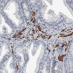 Immunohistochemical staining of human prostate shows strong cytoplasmic positivity in smooth muscle cells.