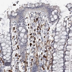 Immunohistochemical staining of human rectum shows strong cytoplasmic positivity in lymphoid cells.