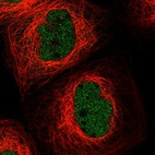 Immunofluorescent staining of human cell line A-431 shows localization to nucleoplasm.