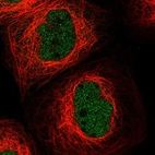 Immunofluorescent staining of human cell line A-431 shows localization to nucleoplasm.