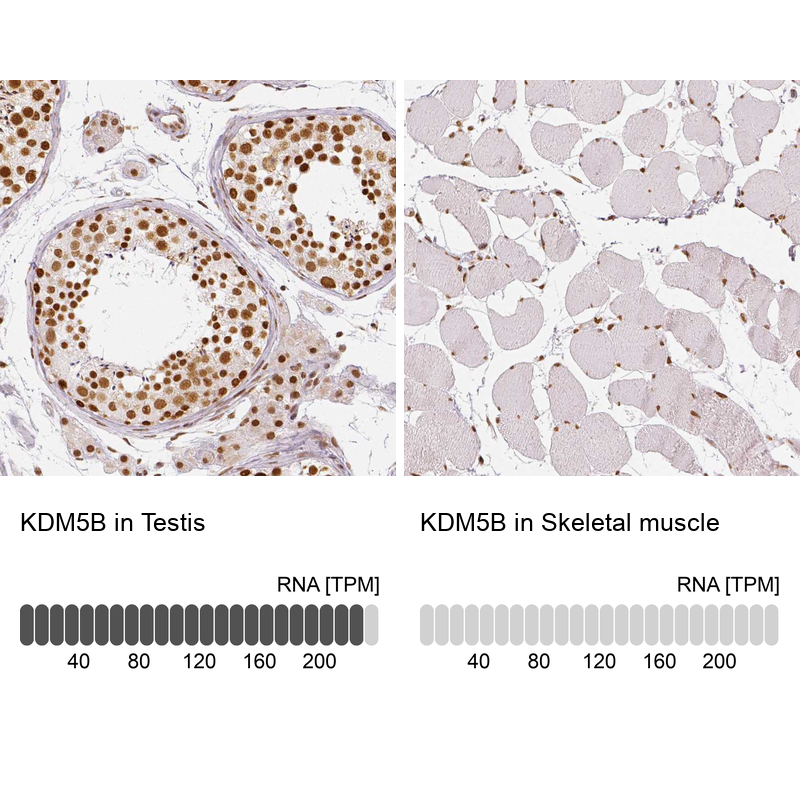 Anti-KDM5B Antibody