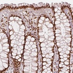 Immunohistochemical staining of human rectum shows moderate to strong nuclear positivity in glandular cells.