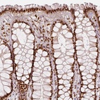 Anti-KDM5B Antibody