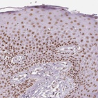 Immunohistochemical staining of human skin shows moderate to strong nuclear positivity in epidermal cells.