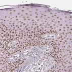 Immunohistochemical staining of human skin shows moderate to strong nuclear positivity in epidermal cells.