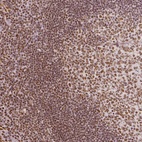 Anti-KDM5B Antibody