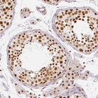 Immunohistochemical staining of human testis shows moderate to strong nuclear positivity in cells in seminiferous ducts and Leydig cells.