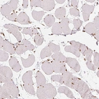 Immunohistochemical staining of human skeletal muscle shows weak nuclear positivity in myocytes.