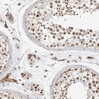 Anti-GPATCH2 Antibody
