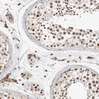 Anti-GPATCH2 Antibody