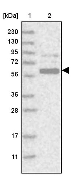 Lane 1: Marker [kDa] 230, 130, 95, 72, 56, 36, 28, 17, 11_br/_Lane 2: Human cell line RT-4