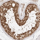 Immunohistochemical staining of human testis shows strong cytoplasmic and nuclear positivity in cells in seminiferous ducts.