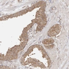 Immunohistochemical staining of human prostate shows moderate cytoplasmic positivity in glandular cells.