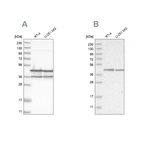 Western blot analysis using Anti-NUDC antibody HPA027183 (A) shows similar pattern to independent antibody HPA028105 (B).