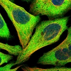 Immunofluorescent staining of human cell line U-2 OS shows localization to cytosol.