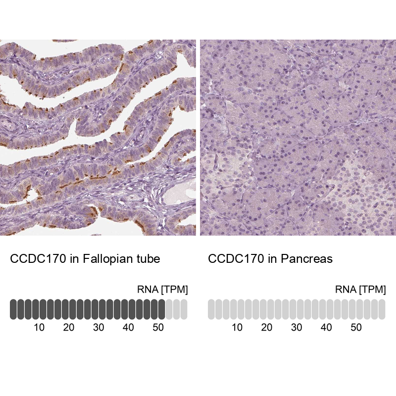 Anti-CCDC170 Antibody