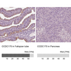 Anti-CCDC170 Antibody